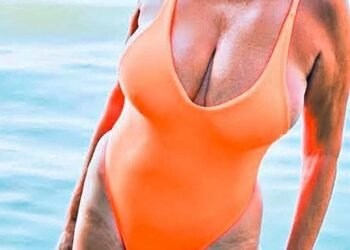 She Was Once Unrecognizable in a Swimsuit — Then Her Incredible Transformation Left Everyone Staring