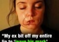She thought it was love, but her ex left her scarred for life