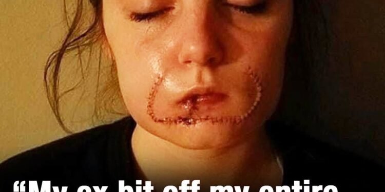 She thought it was love, but her ex left her scarred for life