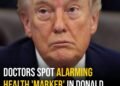 Doctors spot alarming health ‘marker’ in Donald Trump that could raise risk of premature death