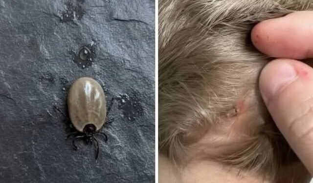 Does Anyone Know What Kind of Bug This Could Be? A Parent Finds an Unusual Insect on a Child’s Scalp
