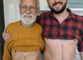 Son who donated part of his liver to his father unfortunately ends up fa