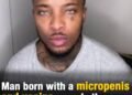 Man born with micropenis and vagina reveals extremely creepy ask he used to get from adults