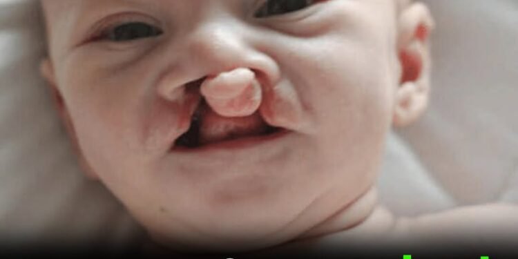 Parents refuse to abort deformed baby when doctors ask – their little boy ended up defying all odds