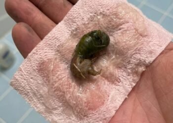 We found this in our bathroom. When I first saw it, I was really scαred.