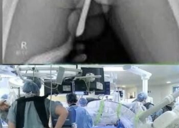 Hospitalized After Risky Experiment
