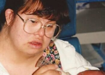 Couple with Down syndrome decide to have children, face criticism