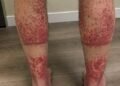 The Shocking Consequences of Sleeping With the…See more
