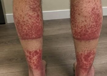 The Shocking Consequences of Sleeping With the…See more