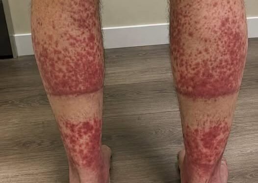 The Shocking Consequences of Sleeping With the…See more