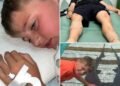 Young boy attacked by three sharks in Bahamas after tourists threw food in water