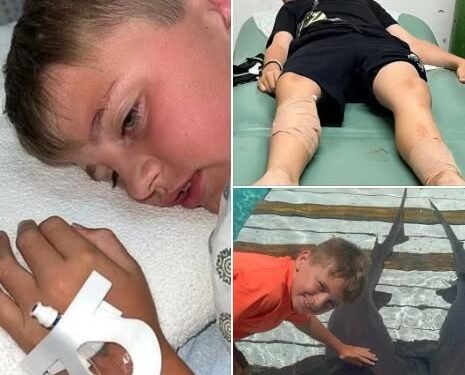 Young boy attacked by three sharks in Bahamas after tourists threw food in water