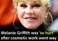 Melanie Griffith shows off new look after dissolving fillers as cosmetic work went “too far”
