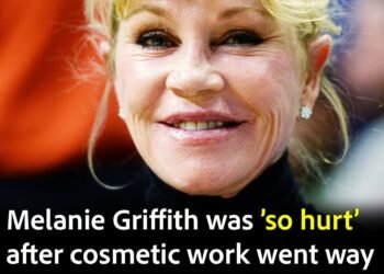 Melanie Griffith shows off new look after dissolving fillers as cosmetic work went “too far”