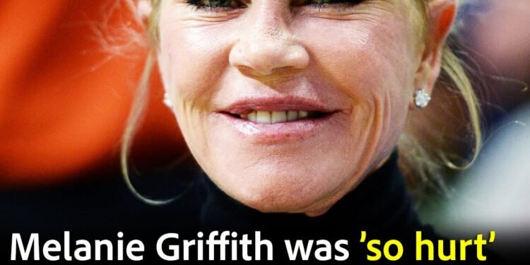 Melanie Griffith shows off new look after dissolving fillers as cosmetic work went “too far”