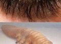 These are the consequences of sleeping with the…